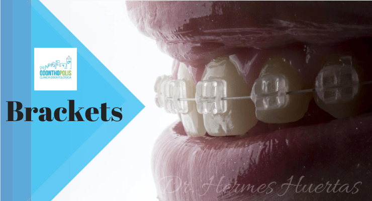Precios de ortodoncia